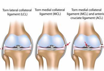 Knee-Injuries-2_0