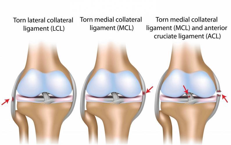 Knee-Injuries-2_0