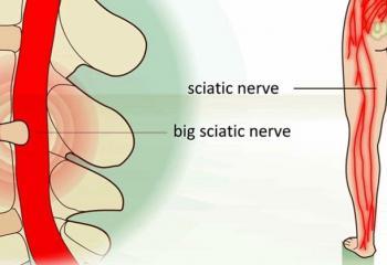 Back Pain Exercises 