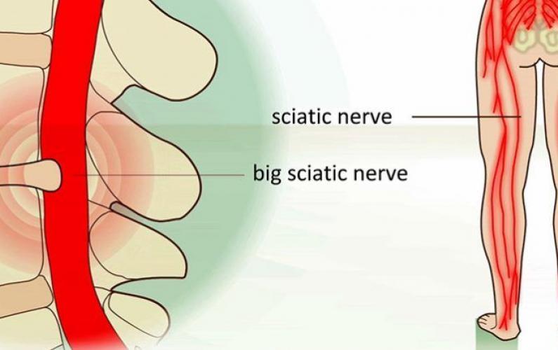 Back Pain Exercises 