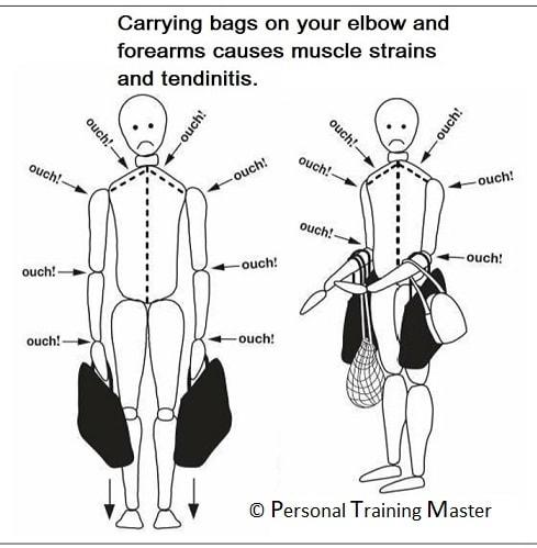 Carrying bags on your elbow and forearms causes muscle strains and tendinitis
