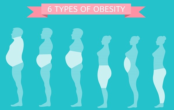 1-Obesity types-8