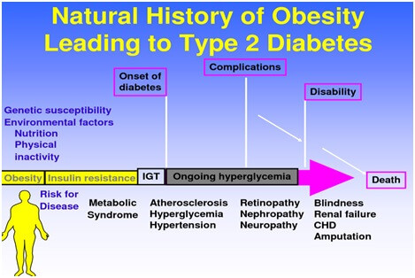 Correlation of Obesity and Type 2 Diabetes