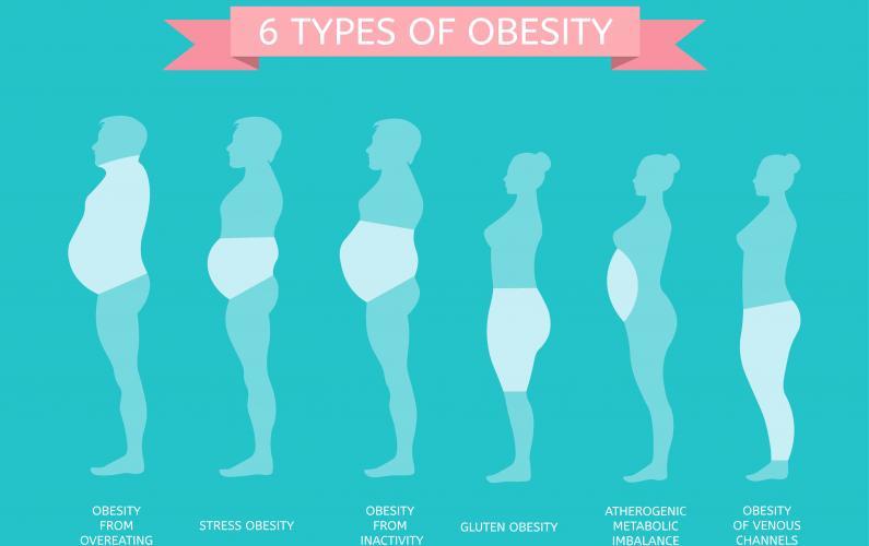 Types of Obesity