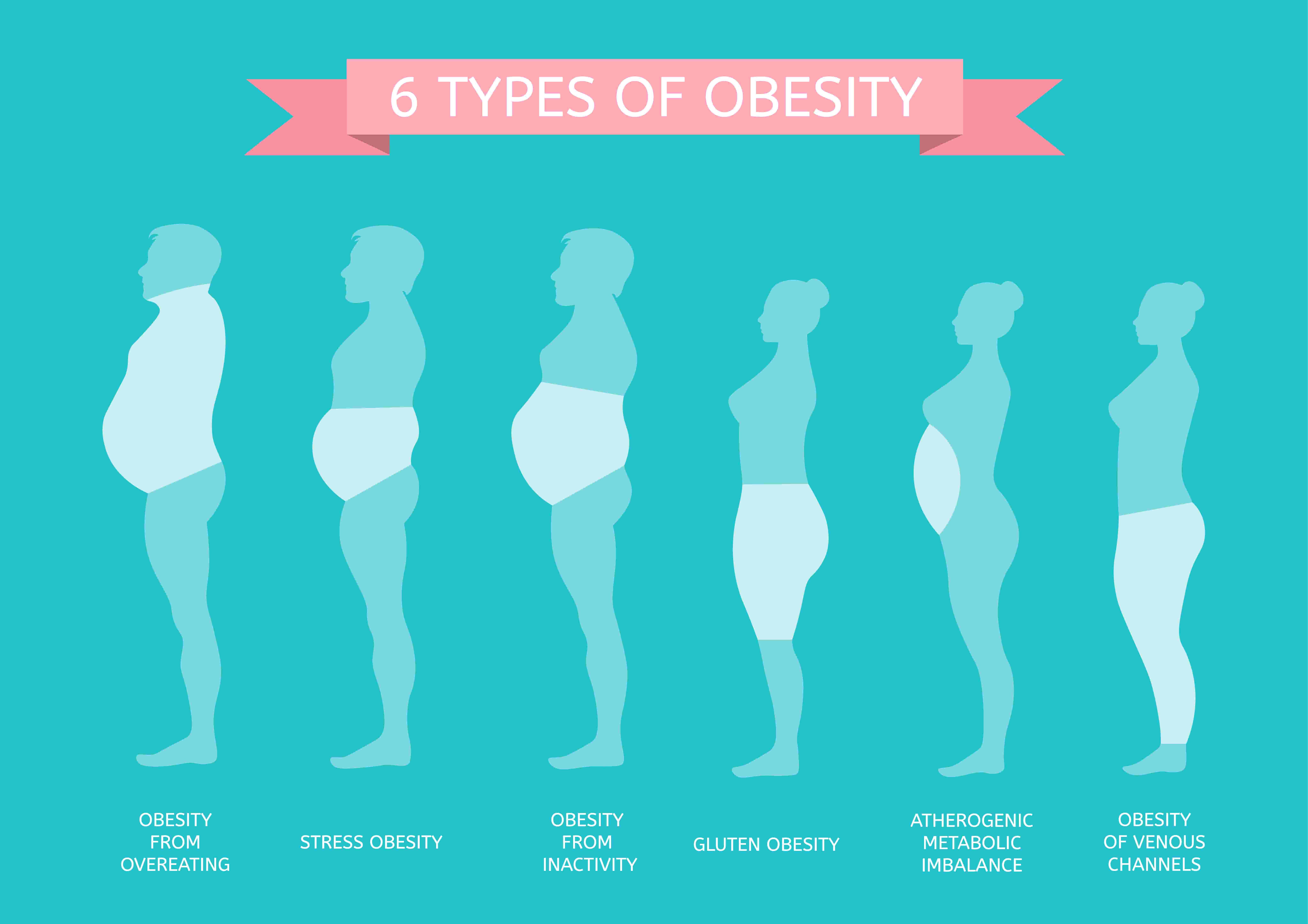 Types of Obesity