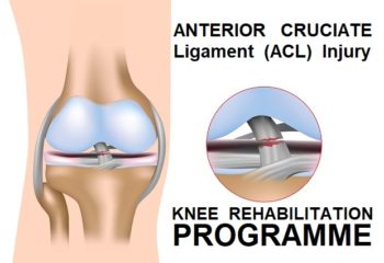 What Is ACL Injury and How to Overcome It with a Sports Injury Rehabilitation Coach in London?