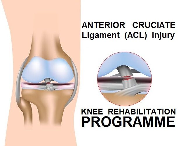 What Is ACL Injury and How to Overcome It with a Sports Injury Rehabilitation Coach in London?