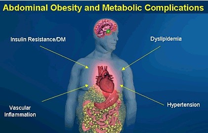 Abdominal obesity