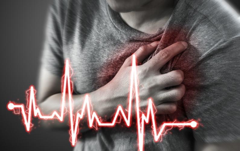 Rehabilitation after Heart Attack