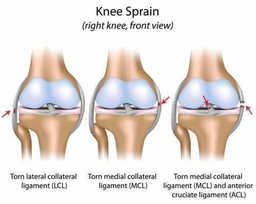 CrossFit Knee injuries-1