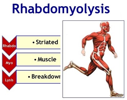 CrossFit-Rabdomyolysis-80 CrossFit-Rabdomyolysis-80