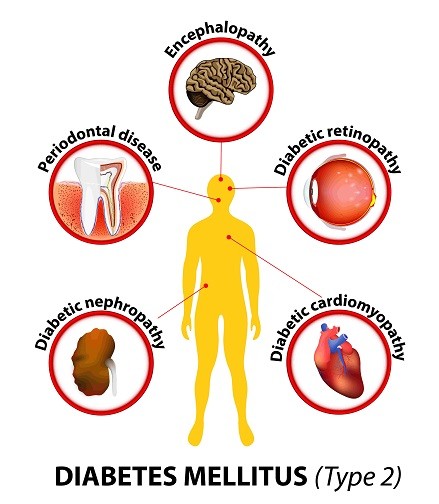 Diabetes type-2-min-7 Diabetes type-2-min-7
