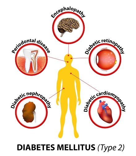 Diabetes type-2-min-7