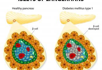 How Diabetes damage occur