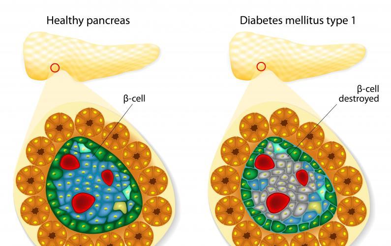 How Diabetes damage occur