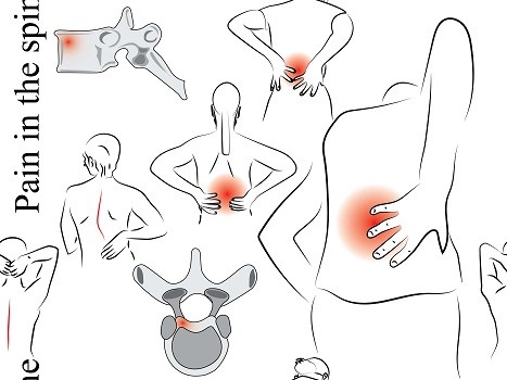 Pain in the Spir rehab