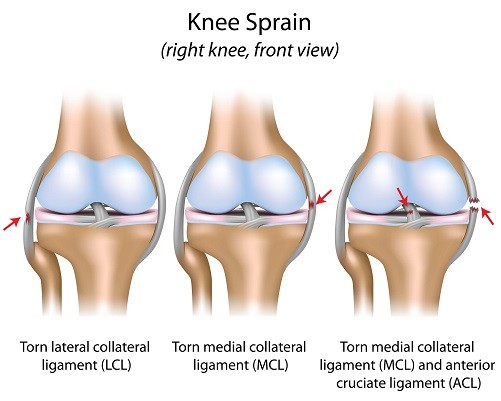 Knee Spain