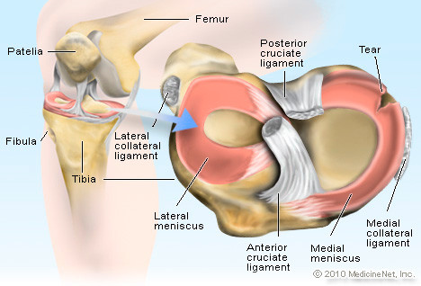 Meniscus Tear Recovery