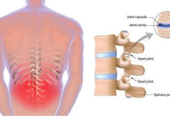 Back Pain Rehabilitation