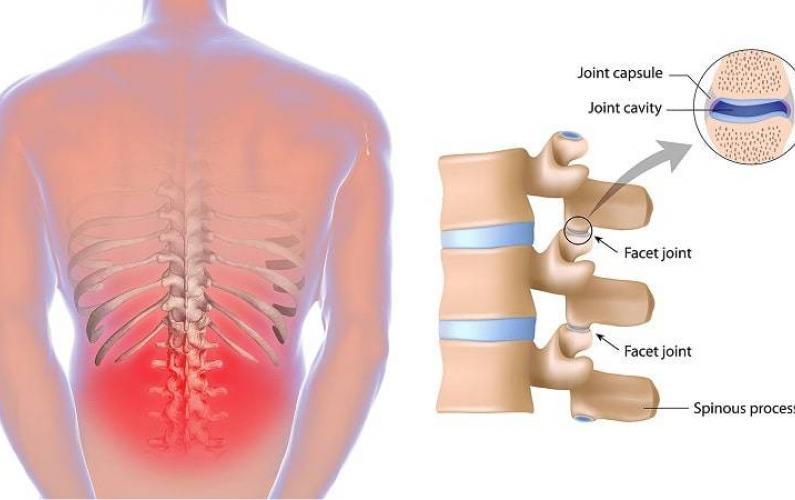 Back Pain Rehabilitation