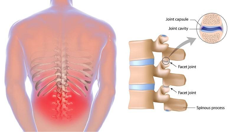 Back Pain Rehabilitation