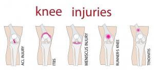 Knee injuries rehab