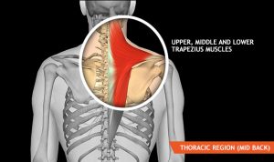 Strained Muscle