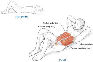 Chest Lift