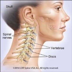 Disc Prolapse