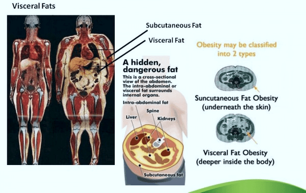 2-visceral-fat-graphic-min