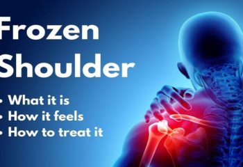How to Cure Frozen Shoulder