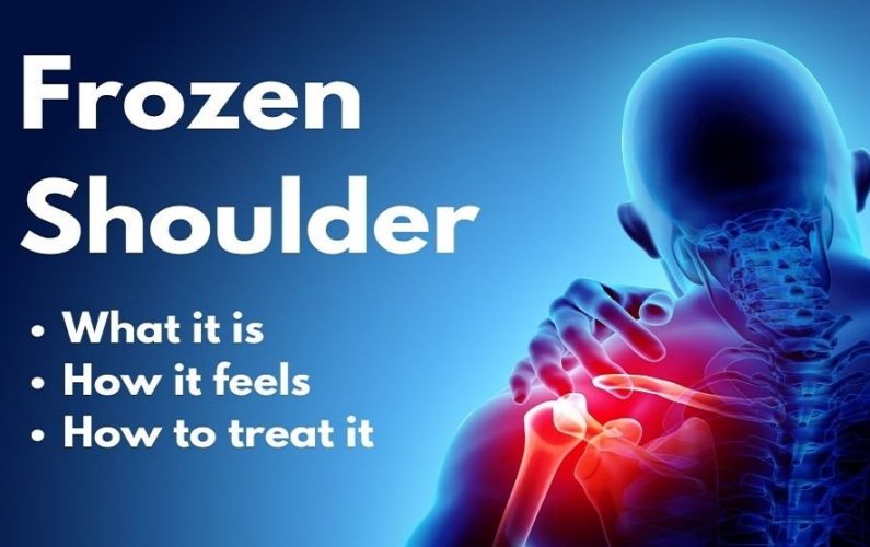 How to Cure Frozen Shoulder