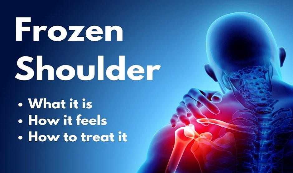 How to Cure Frozen Shoulder