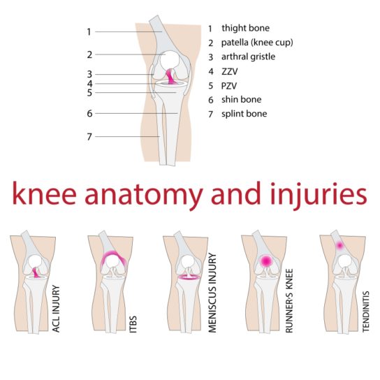2-Types of Knee Injuries