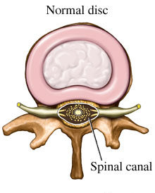 Normal Disc