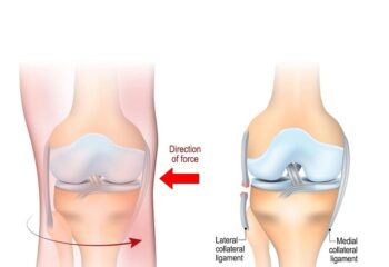 Lateral Collateral Ligament-40-1-min