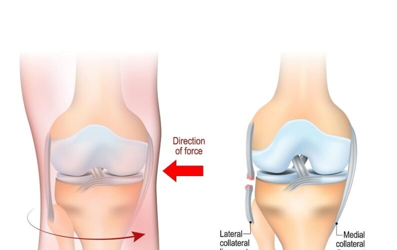 Lateral Collateral Ligament-40-1-min