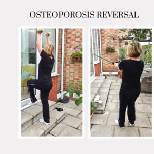 osteoporosis-rehabilitation-exercise